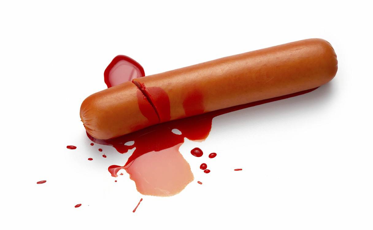 Hiện tượng xuất tinh ra máu ở nam giới là gì? (Ảnh minh họa)