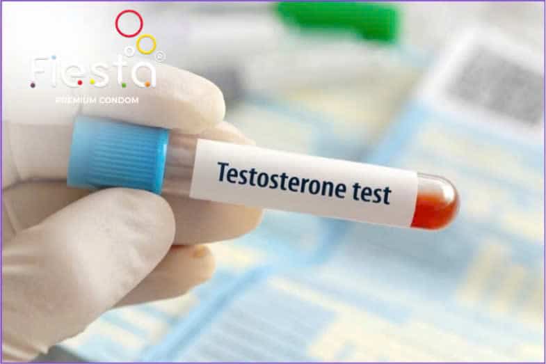 Xét nghiệm nồng độ testosterone trong máu.