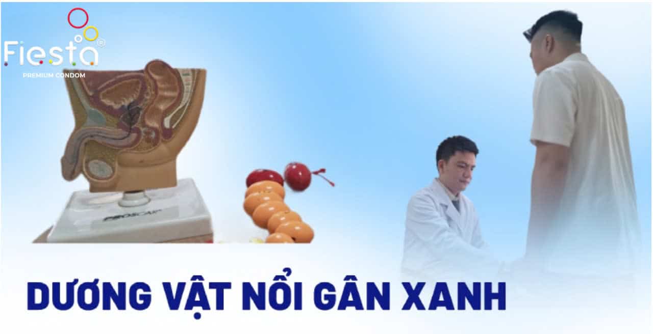 Dương vật nổi gân xanh nguyên nhân do đâu? Có nguy hiểm không?